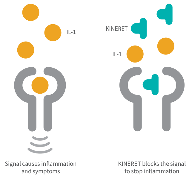 A diagram showing how KINERET blocks IL-1 signaling