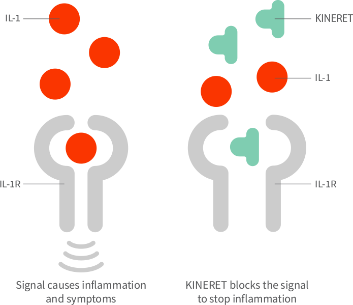 An illustrated diagram of how KINERET blocks IL-1 signaling