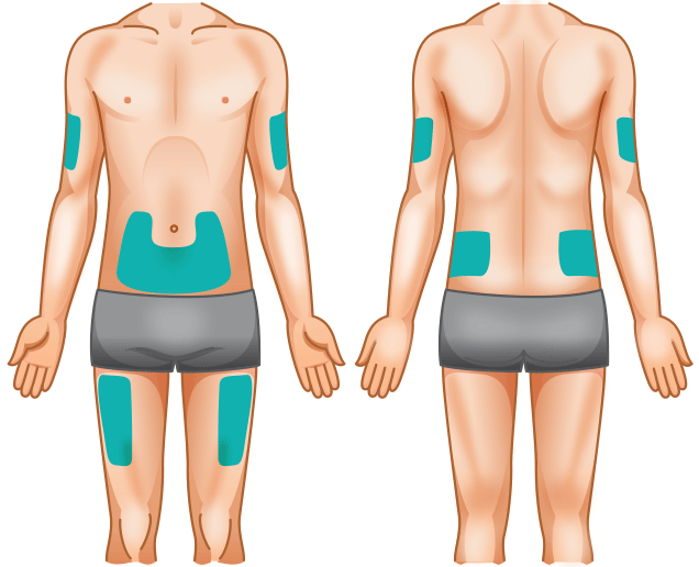 Diagram showing adult injection sites