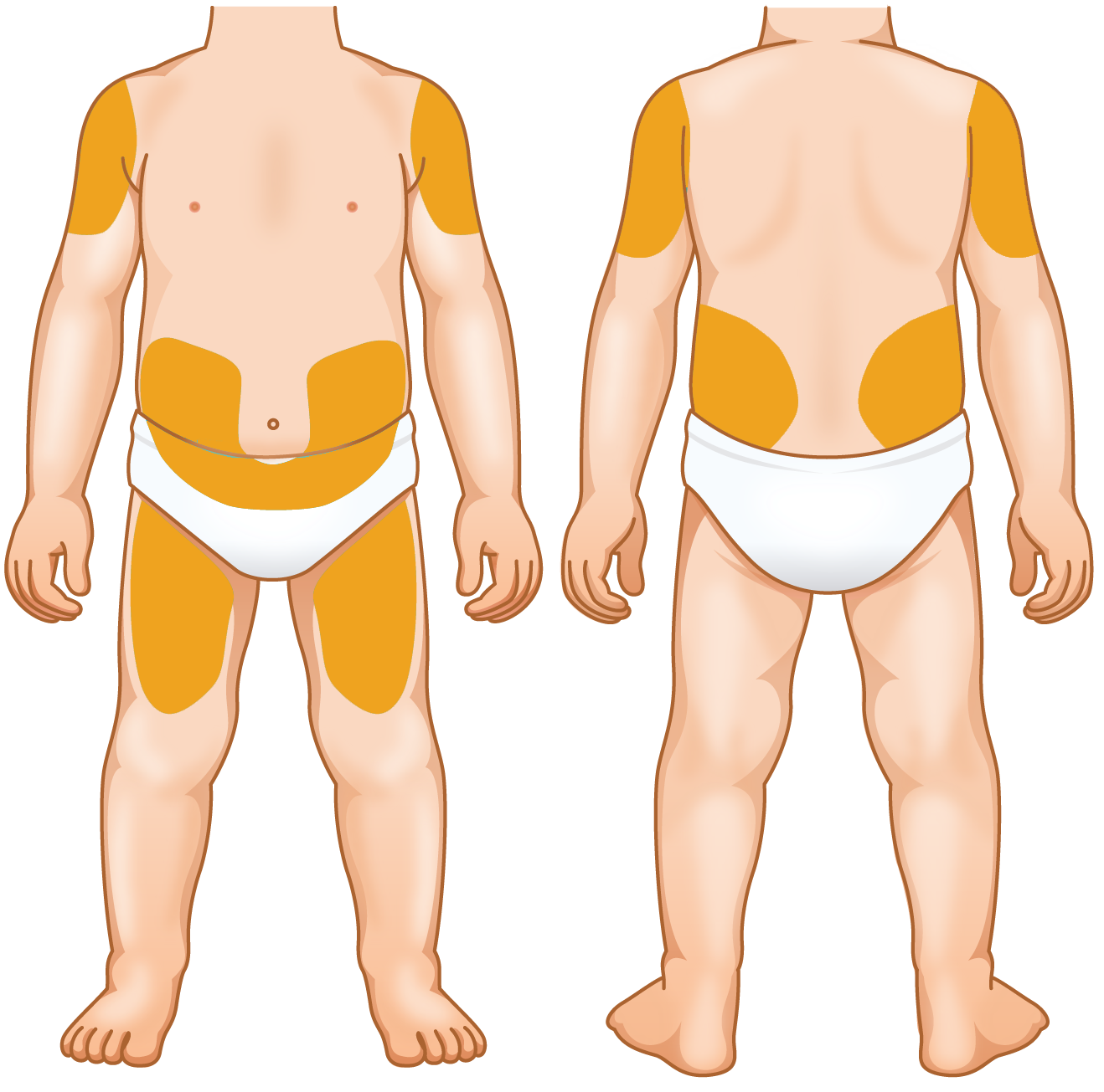 Diagram showing child injection sites